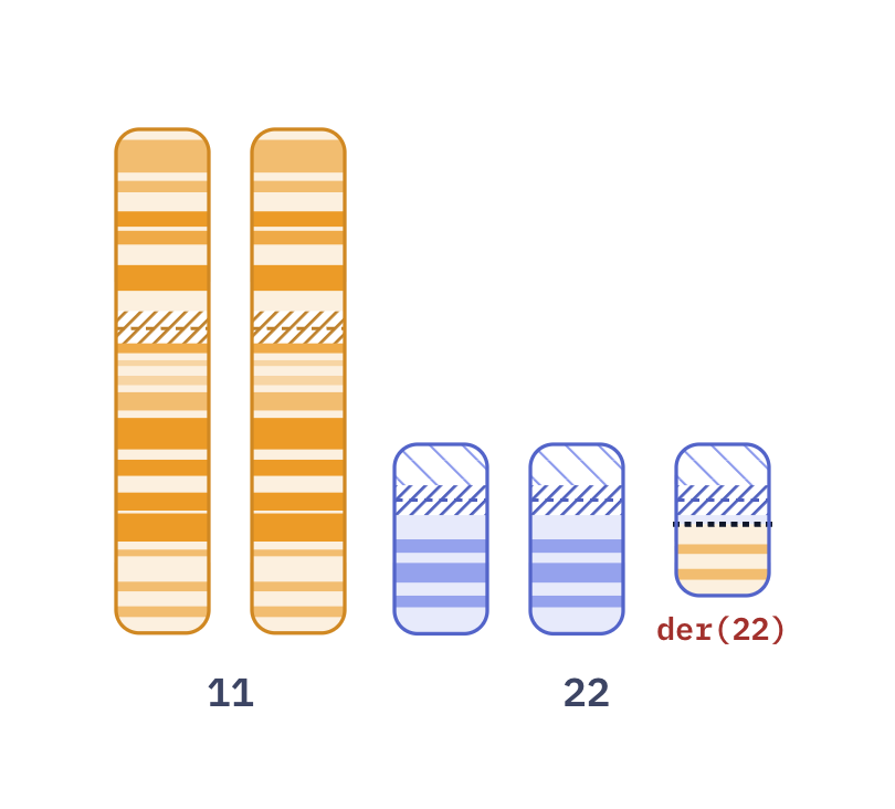 Karyotype of Emanuel syndrome (47,XX,+der(22)t(11;22)(q23;q11.2))