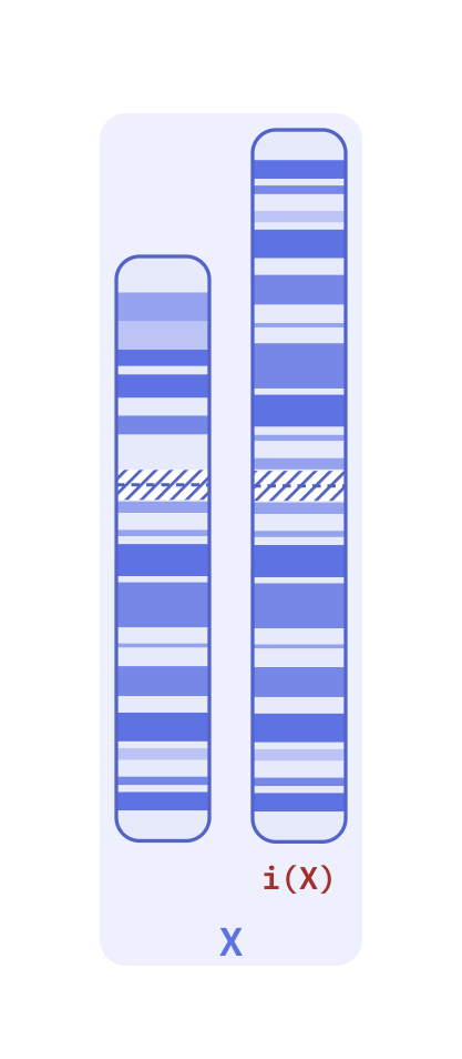 Karyotype of Isochromosome Xq (46,X,i(X)(q10))