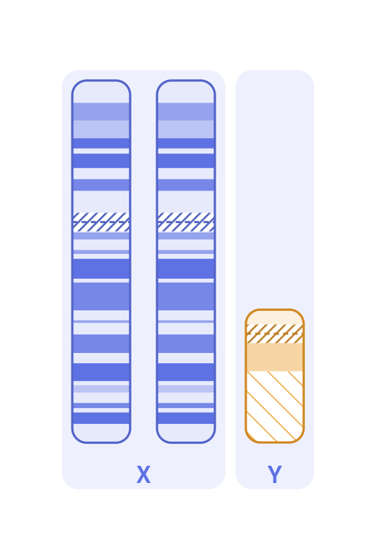 Karyotype of Klinefelter syndrome (47,XXY)