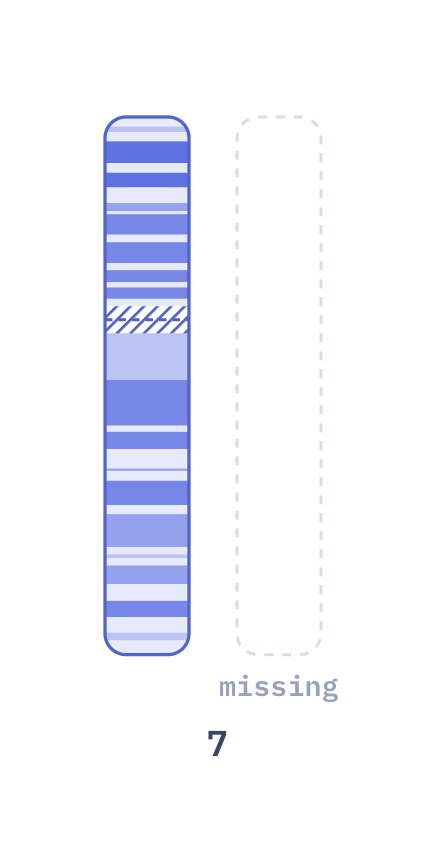 Karyotype of Monosomy 7 (MDS/AML) (45,XX,-7)