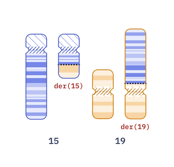 Karyotype of NUT carcinoma t(15;19) (46,XY,t(15;19)(q14;p13.1))