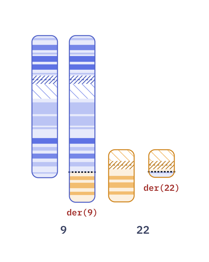 Karyotype of Philadelphia chromosome (46,XY,t(9;22)(q34;q11.2))