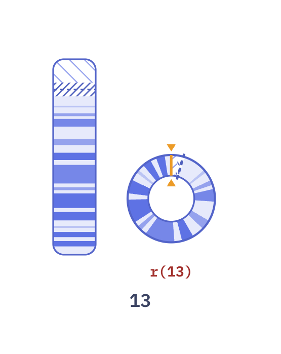 Karyotype of Ring chromosome 13 (46,XY,r(13)(p11q34))