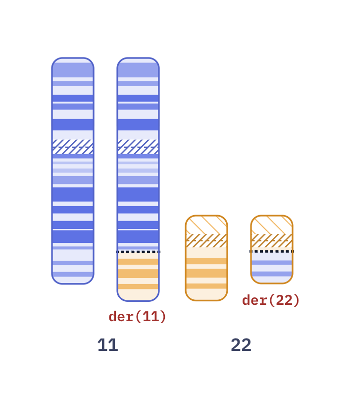 Karyotype of Balanced t(11;22) carrier (46,XX,t(11;22)(q23;q11.2))