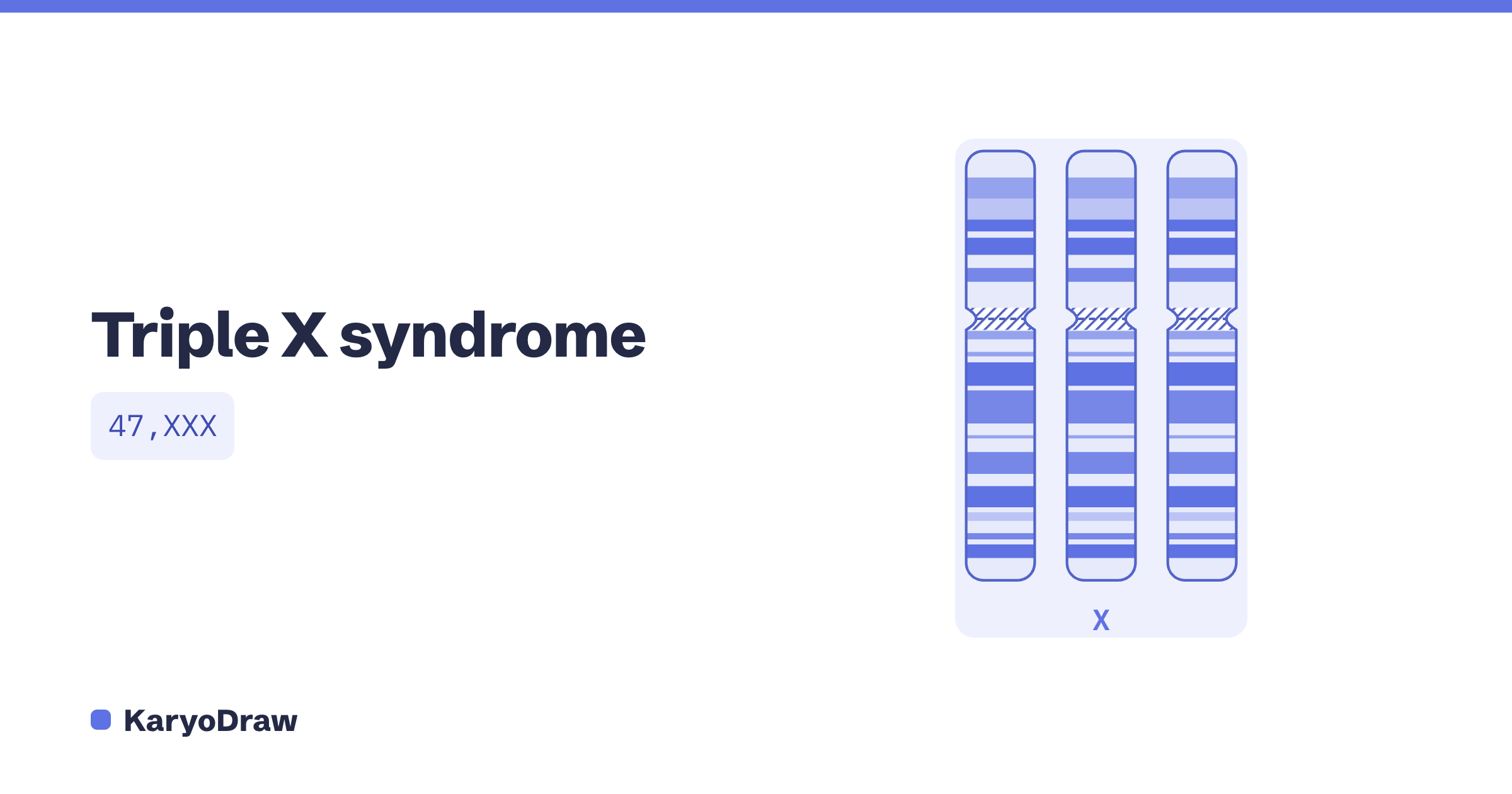 Triple X syndrome karyotype (47,XXX) explained | KaryoDraw