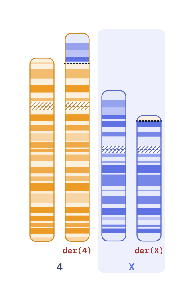 Karyotype of X-autosome translocation, manifesting female carrier (46,X,t(X;4)(p21;p16))