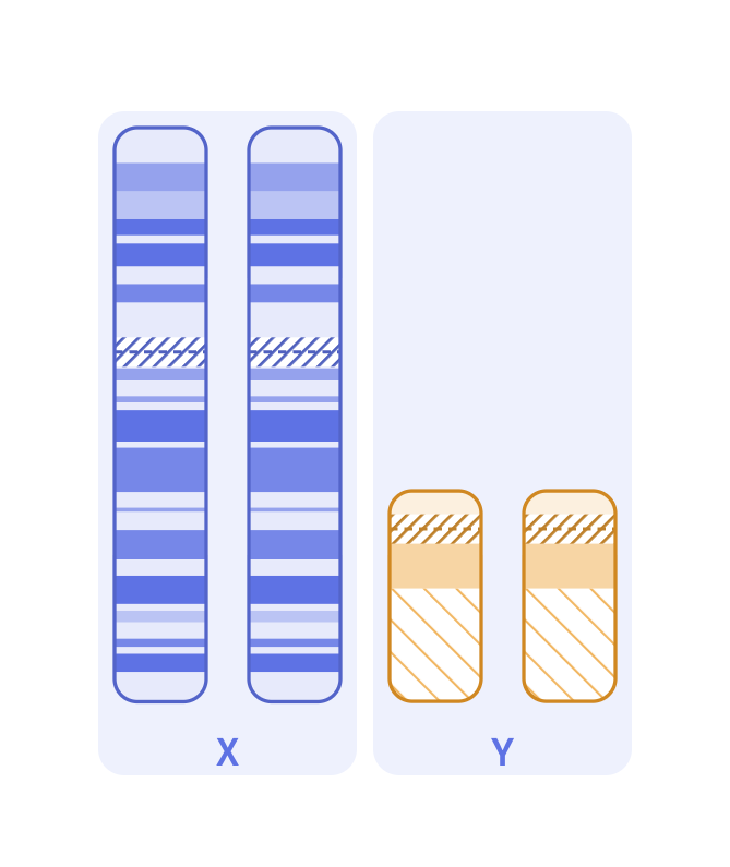 Karyotype of XXYY syndrome (48,XXYY)