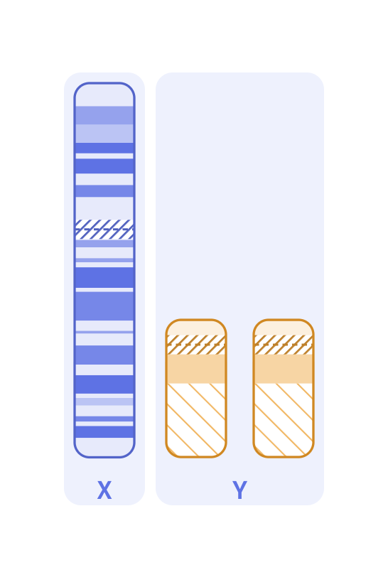Karyotype of XYY syndrome (47,XYY)